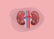 Korban Jual Ginjal Internasional Terima Restitusi Senilai Rp.33.314.250