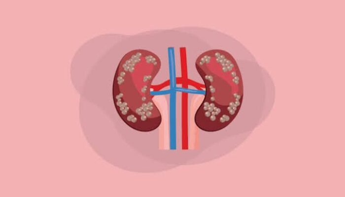 Korban Jual Ginjal Internasional Terima Restitusi Senilai Rp.33.314.250