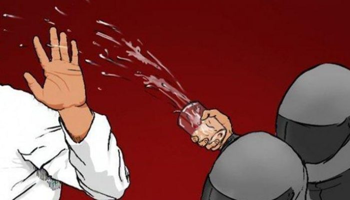 Seorang Pria di Tangerang Disiram Air Keras Oleh Gerombolan Tak Dikenal