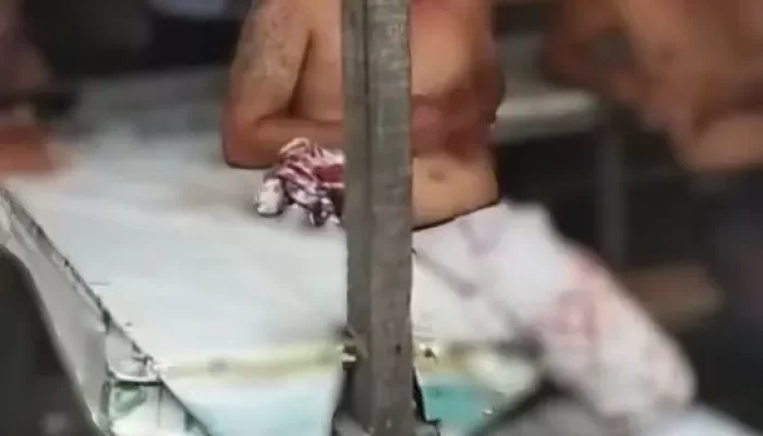 Dua Sopir Bus Saling Tikam di Pematangsiantar