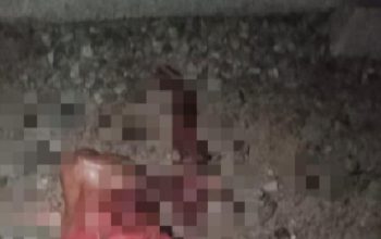 Ketiduran di Rel Kereta Api, Tubuh Pemuda Asahan Ini Terpisah